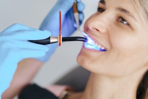 Laser Dentistry